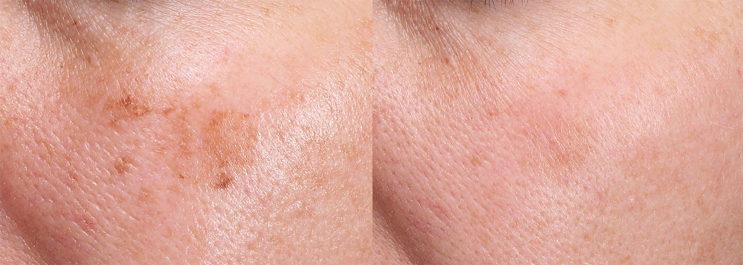 Harmony B&A