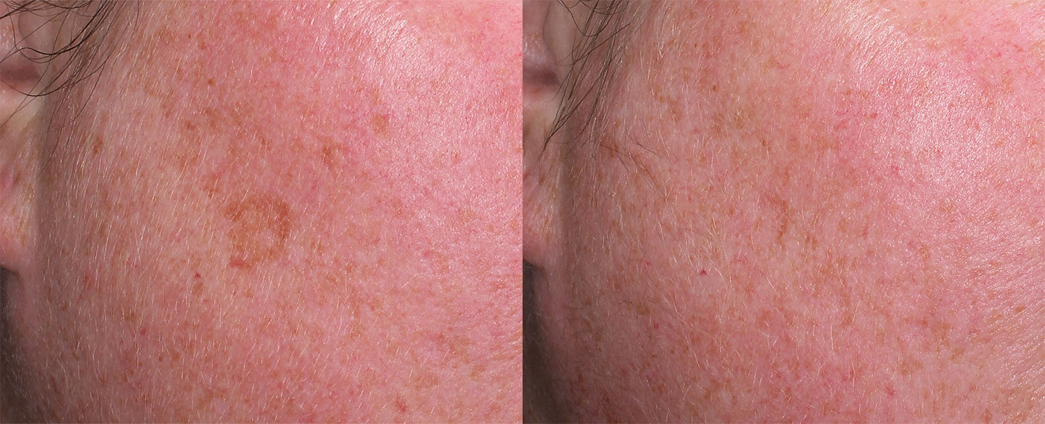 Harmony B&A